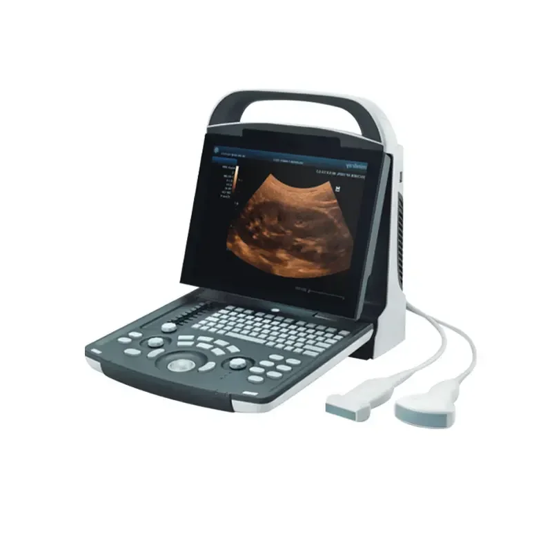 

DP-10 Personal Outpatient B-ultrasound Notebook Ultrasound System Abdominal Black and White B-ultrasound Machine