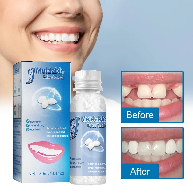 Temporary Tooth Repair Beads Missing Broken Teeth Dental Tooth Filling  Material Food Grade False Teeth Solid Glue Denture - AliExpress