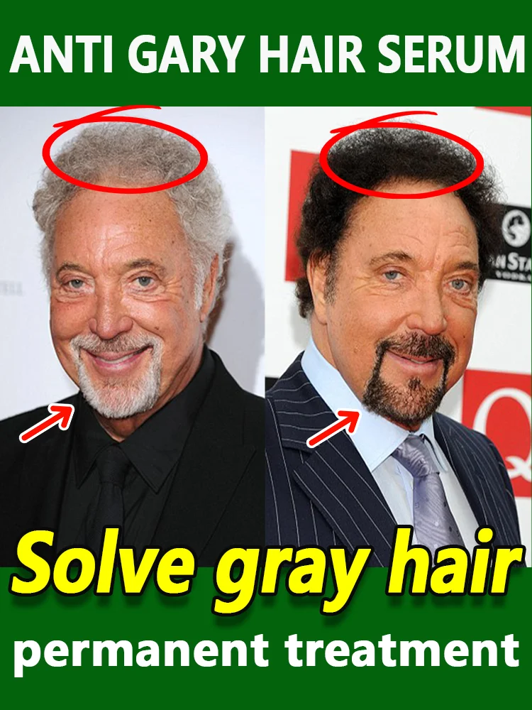 안티 그레이 헤어 내추럴 트리트먼트 세럼 