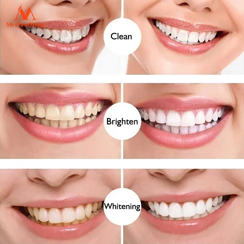 New Teeth Whitening Pen Tooth Gel Whitener Bleach Remove Stains Instant