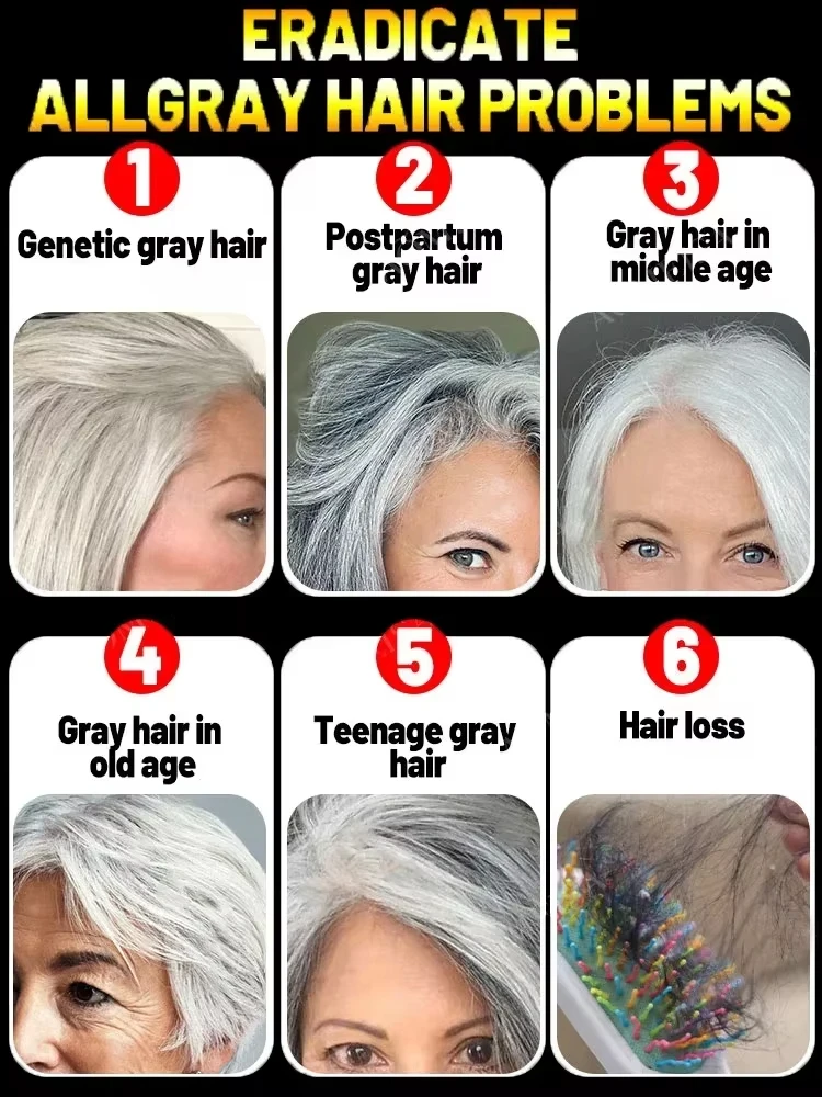 White hair killer remove gray hair and restore natural color in 7 days