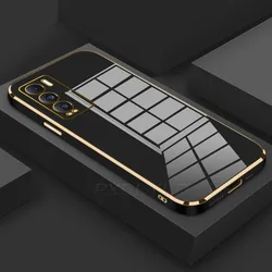 Luxury Glossy Plated Full Cover Soft Phone Case for Nova 12 (Black)