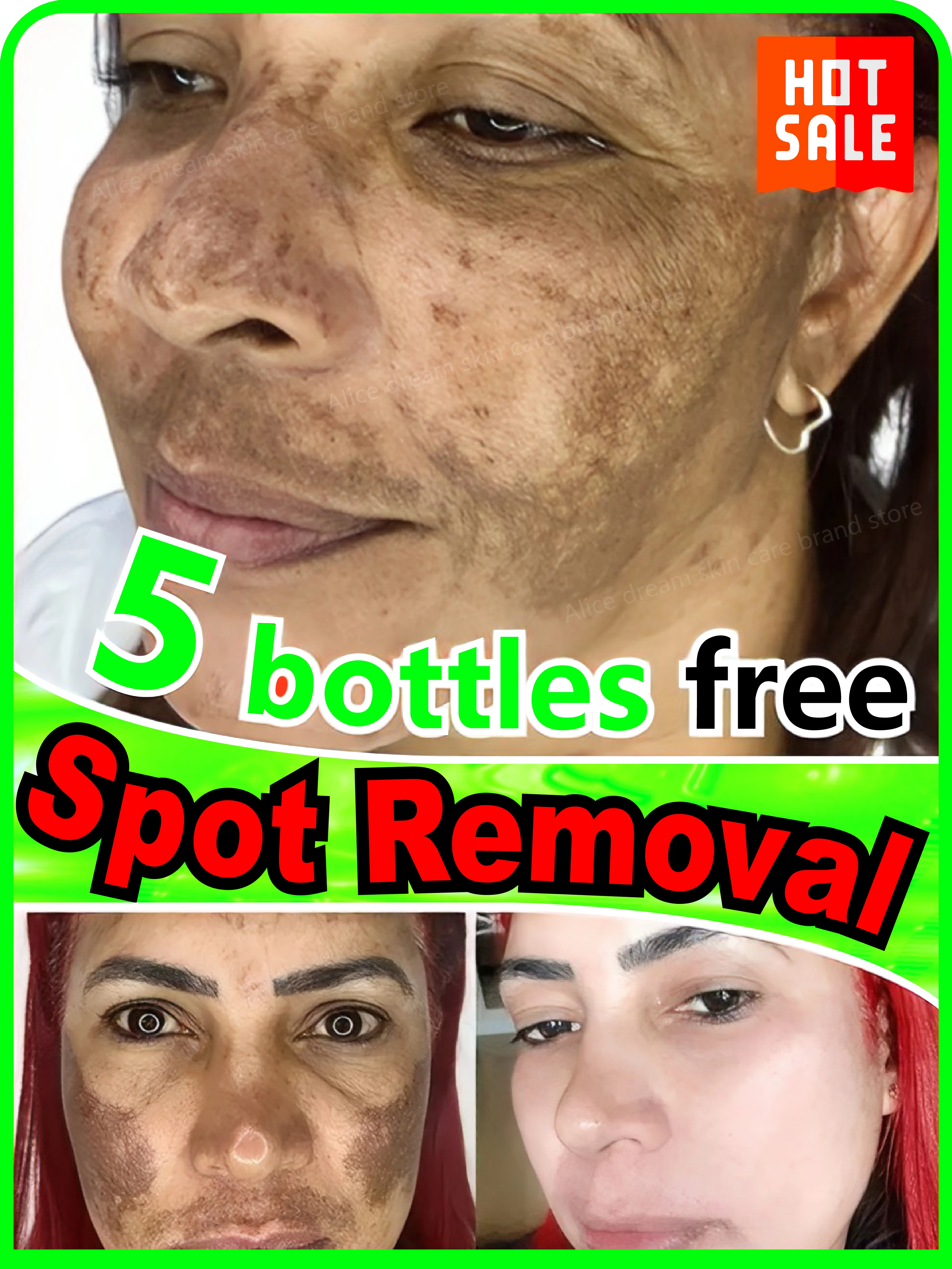 Facial Serum Effectively solves all pigmentation symptoms
