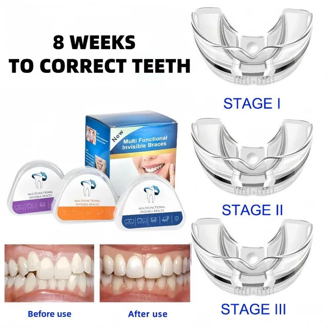 Adults Kids Three Stages Silicone Tooth Invisible Orthodontic Set Dental Appliance Teeth Retainer Mouth Guard Braces Tooth Tray