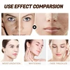 Salicylic Acid Pores Shrink Cream Refining Large Pore Improve Face Acnes Blackhead Remove Cream Anti-aging Oil Control Skin Care 4