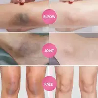 Inner Thigh Brighten Cream Bleaching Armpits Elbows Knees Moisturizing Body Lotion Cream Brighten Lightening Melanin Skin Cream 2