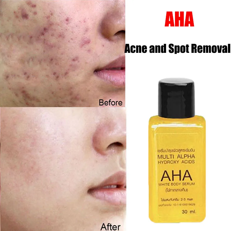 Glycolic Acid Brightening Face Serum Alpha Hydroxy Acid AHA Removal Dark Spots Korea Facial Chemical Exfoliation Anti Wrinkle