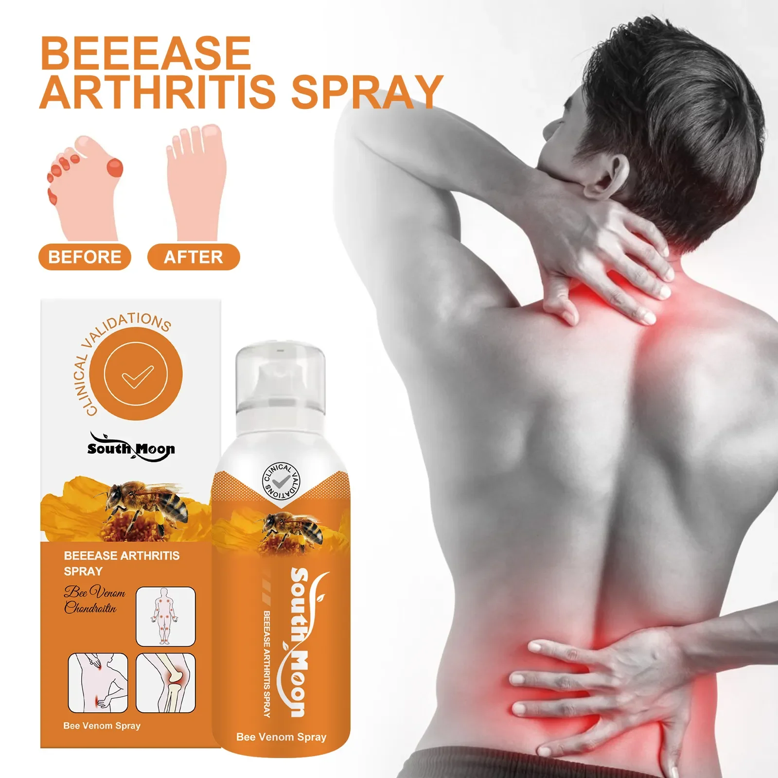 

Personal Health Care Joint Repair Spray Relieves joint pain Shoulder vertebra Lumbar Body Care spray Prevent heel skin damage