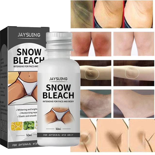 Inner Thigh Lightening Cream, Strong Dark Spots Eraser, Spotless Skin -  Body Creams - AliExpress