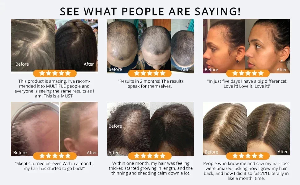 Description Picture 3 of itemHair Oil Hair Growth Products Prevent Hair Loss Essential Oils Rapid Growth Anti-Drying Scalp Treatment Repair Health Beauty 60g