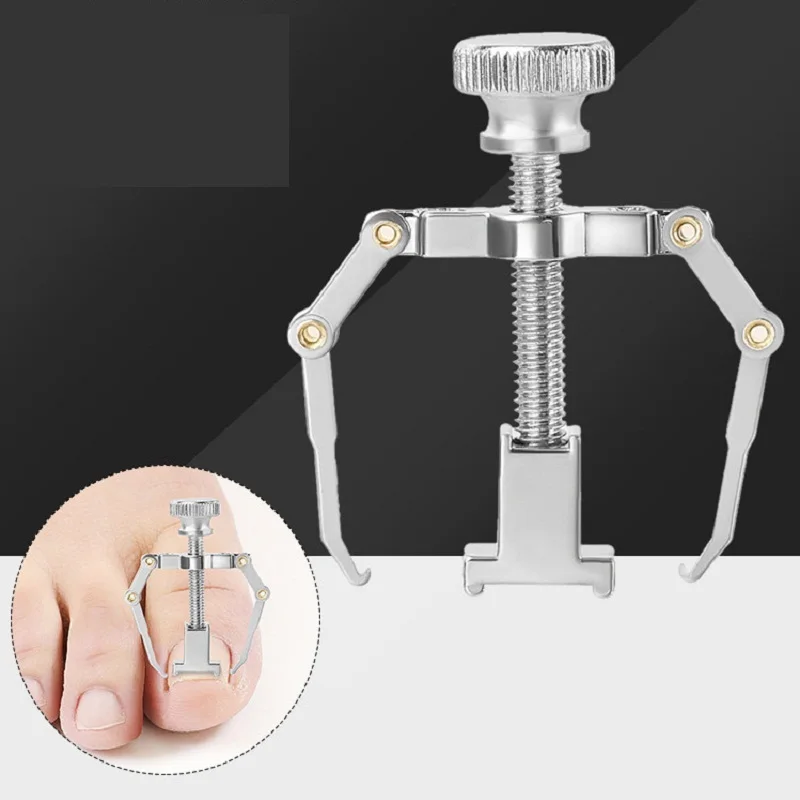 

Ingrown Toenail Corrector Curly Toenail Appliance Nail Patch Paronychia Busters Special Pull Nail Groove Beauty Onychocryptosis