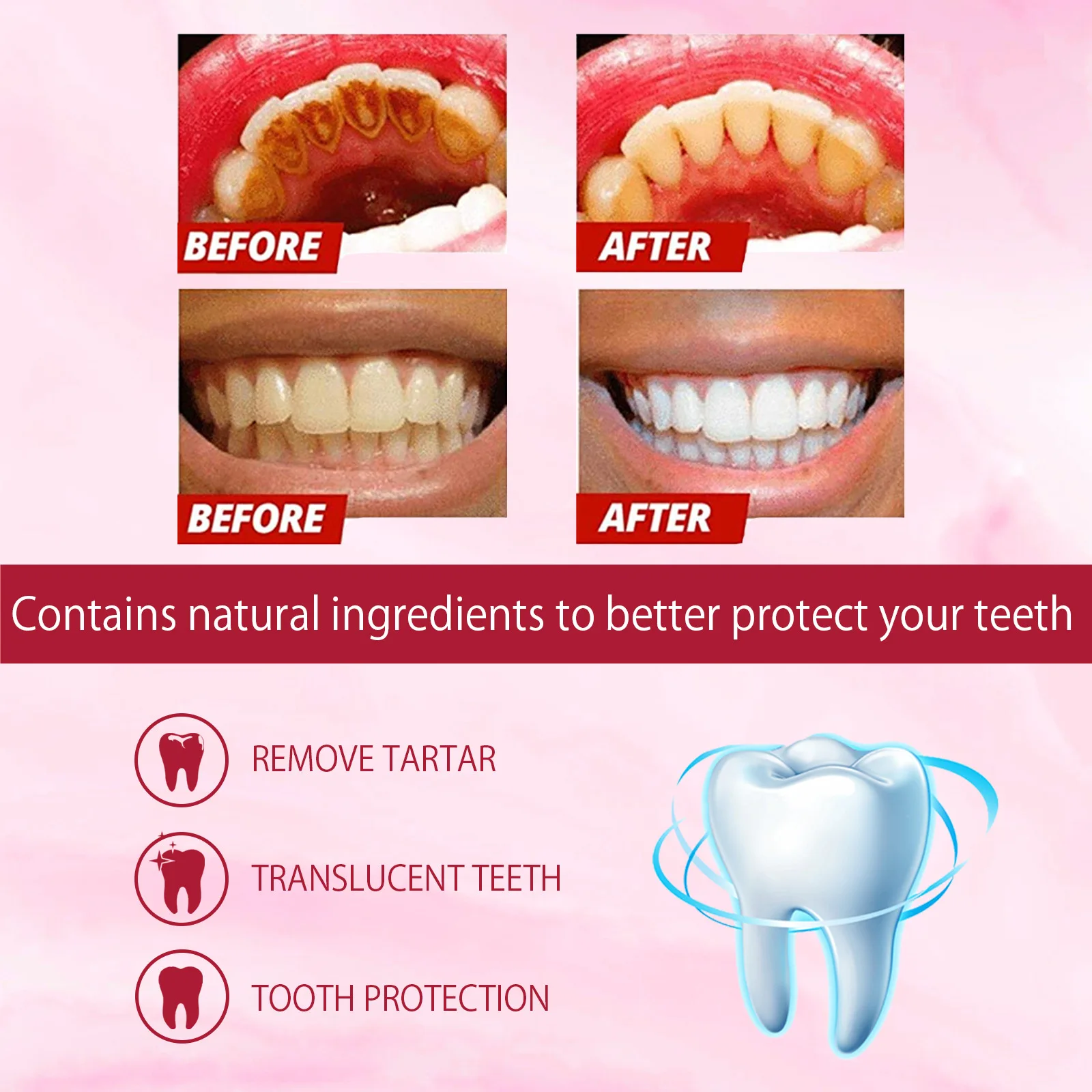Probiotic Caries Toothpaste SP 4 Whitening Tooth Decay Repair Paste Teeth Cleaner Plaque Remover Fresh Breath Dental Care 120g