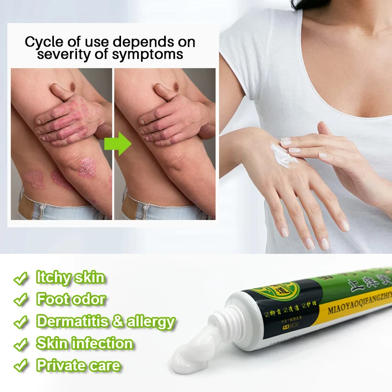 2pcs Psoriasis Mint Anit-itch Cream Jock Itch Beriberi Fungal Infection Treatment Ointment Medical Herbal Psoriasis Cream A1442