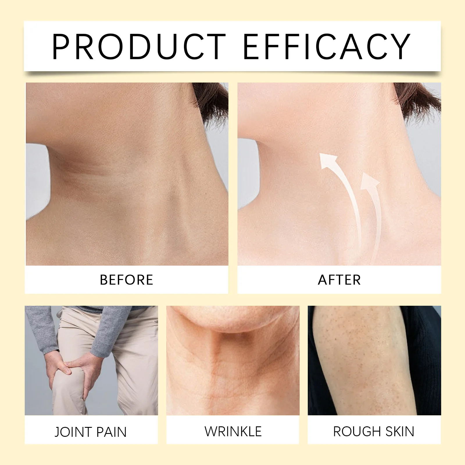 Bee Venom Anti Arthritis Gel Rheumatoid Neck Shoulder Back Pain Relief Tenosynovitis Care Muscle Strain Massage Joints Analgesic