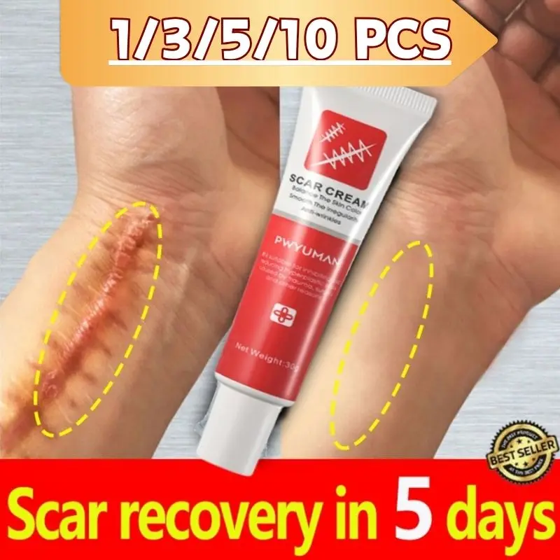 

Scar Removal Cream Treatment Stretch Marks Burn Surgical Scar Acne Spots Fast Repair Gel Whitening Moisturizing Smooth Skin Care