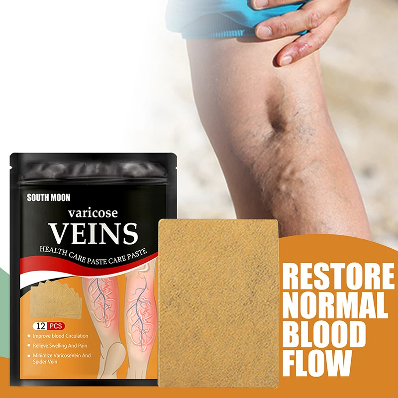 South Moon Varicose Veins Phlebitis Spider Earthworm Leg Relief Patch Anti Swelling for Foot Health Care Removal Pain 12pcs