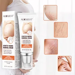 AUQUEST Stretch Marks Removal Cream For Pregnant Women Maternity White Toned Stretch Scars Buttock Belly Firming Cream 45g