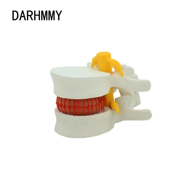 

Устройство для увеличения позвоночника DARHMMY