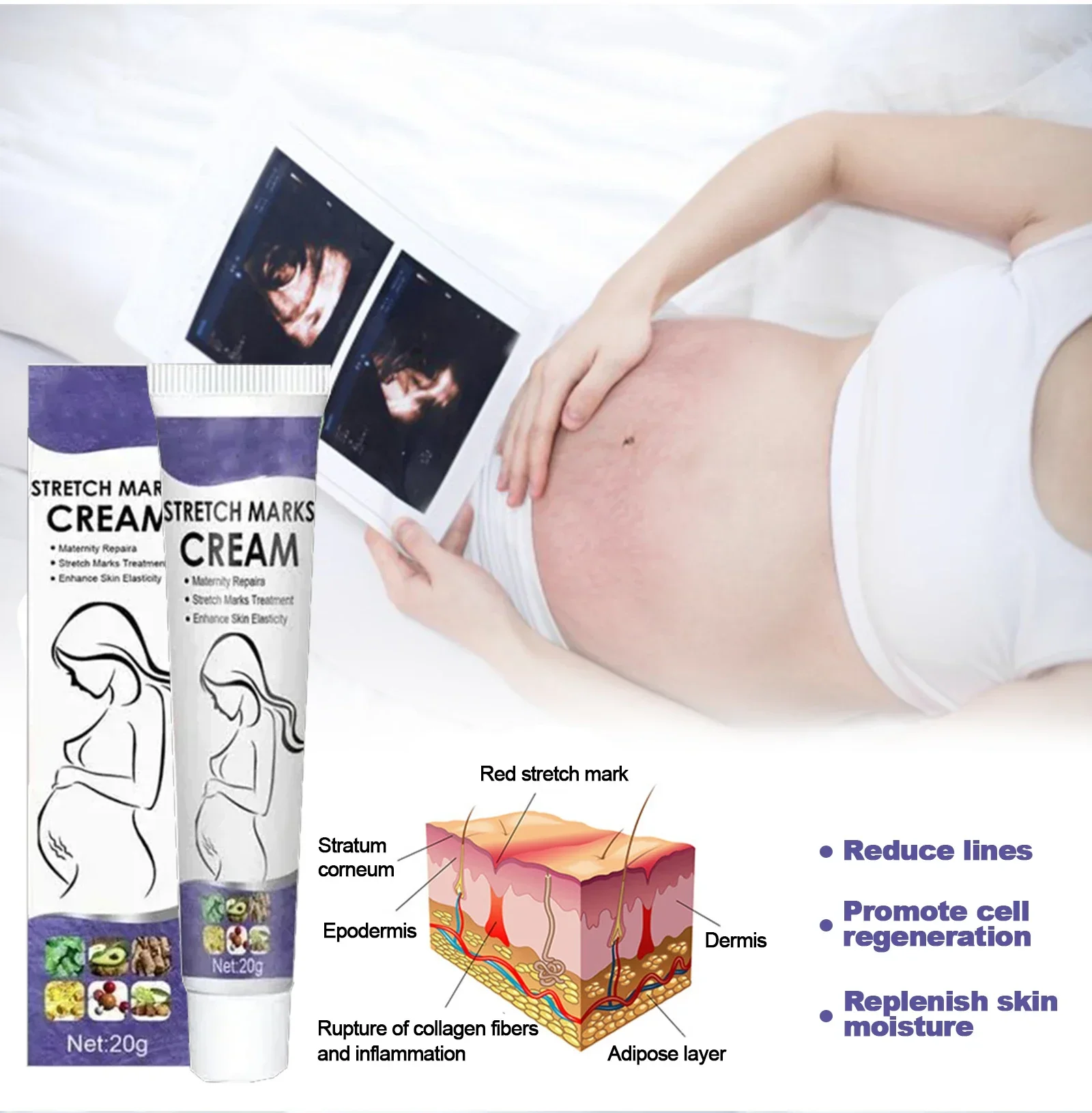 Body Care Cream Stretch Mark Removal Permanently Rejuvenates Skin
