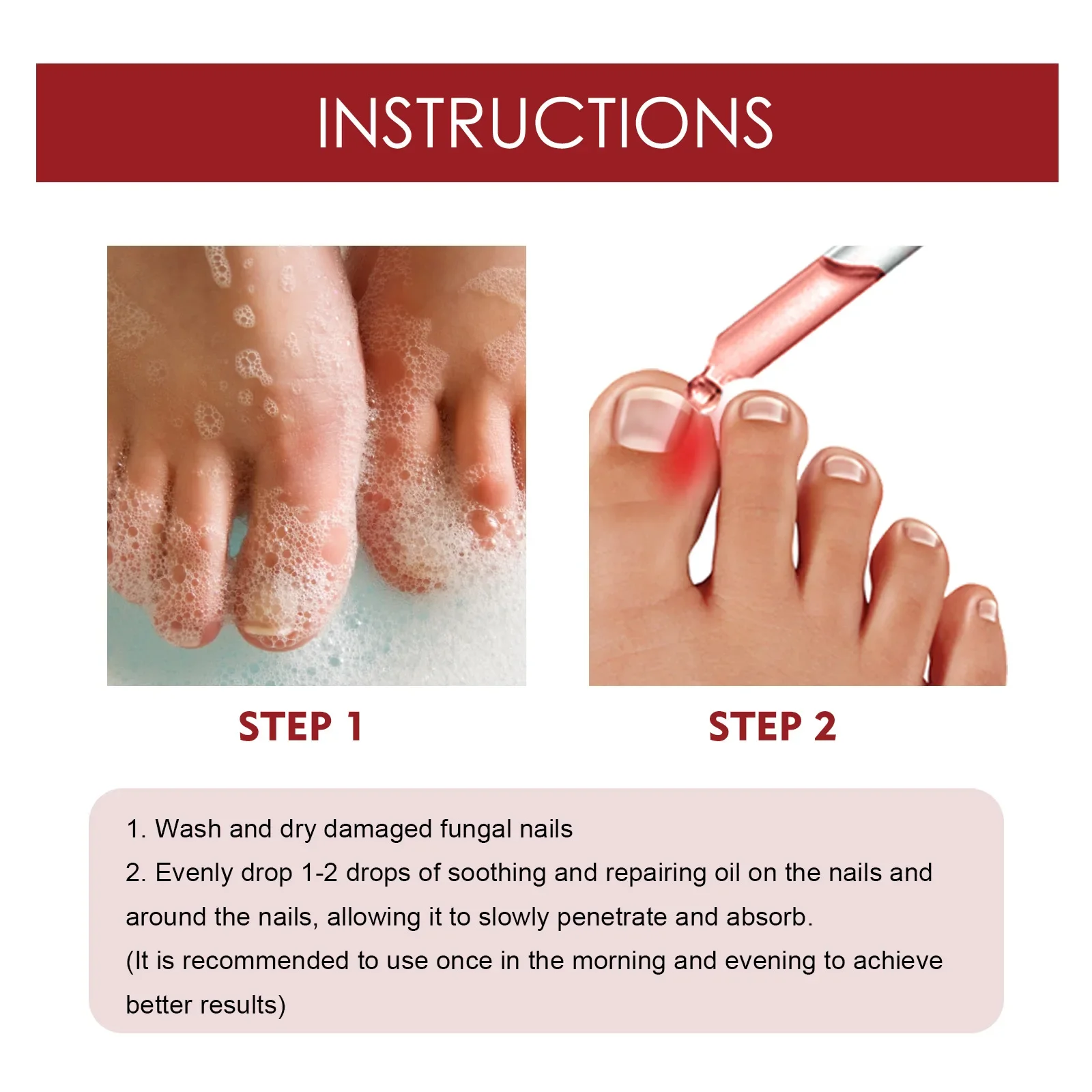10ml Paronychial Sulcus Nursing Oil Repair Ingrown Armor Grey Nails Paronychial Sulcus Relieve Soft Armor Bright 발톱무좀