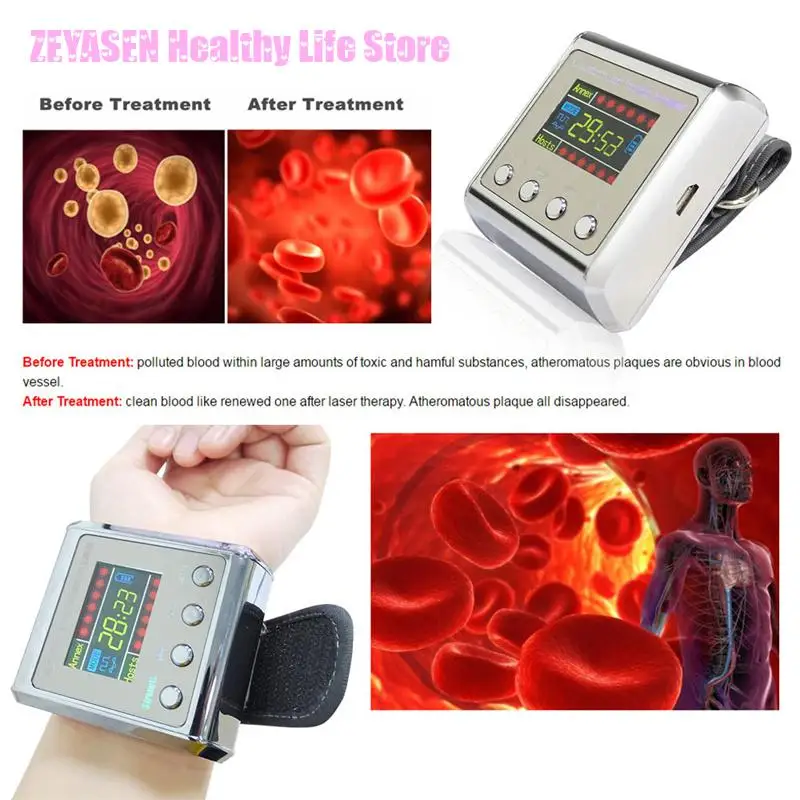 Household Laser Physiotherapy Wrist Diode Lllt Laser Therapy Diabetic Wrist Watch For Diabetes Hypertension Sinusitis Treatment