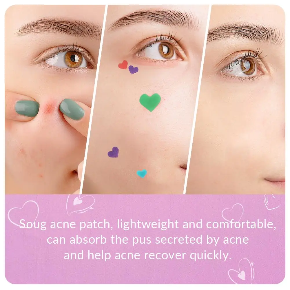 Acne Pimple Patch Stickers Blemish Spot Concealer