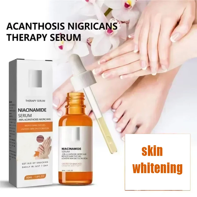 Dark Knuckles Whitening Serum Elbows Armpit Beaching Serum Woman Skin Removal Dark Knuckles skin whitening serum
