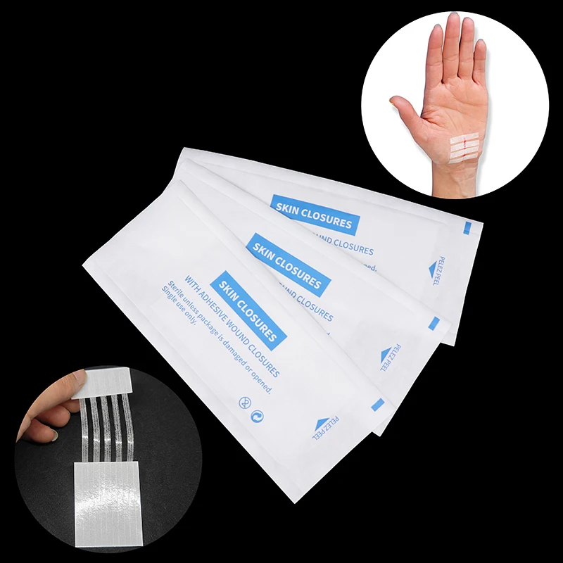 2/5 Streifen Wund haut verschluss streifen postpartale Wund reparatur kosmetische Chirurgie Streifen kleber medizinische Naht freies chirurgisches Klebeband – Detail 8
