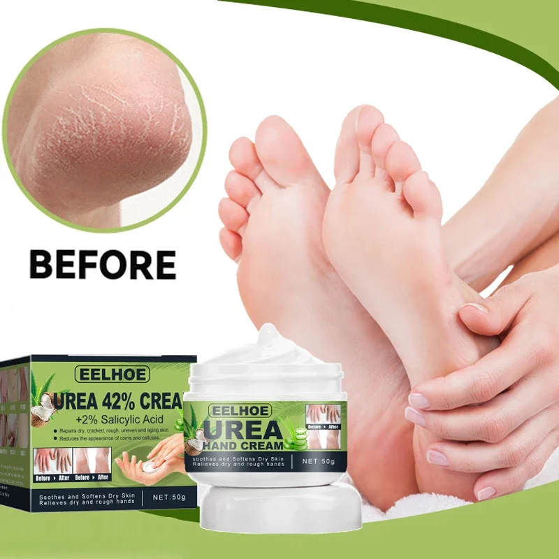 Urea Cream Hand Foot Care Anti-Dry Screpoled Esfoliation Removal Dead Skin Addolcimento Idratante Mani Piedi Maschera Di Riparazione