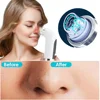 Blackhead Remover Pore Vacuum Face Cleaner Electric Pimple Black Head Removal USB Rechargeable Water Cycle Facial Cleaning Tools 3