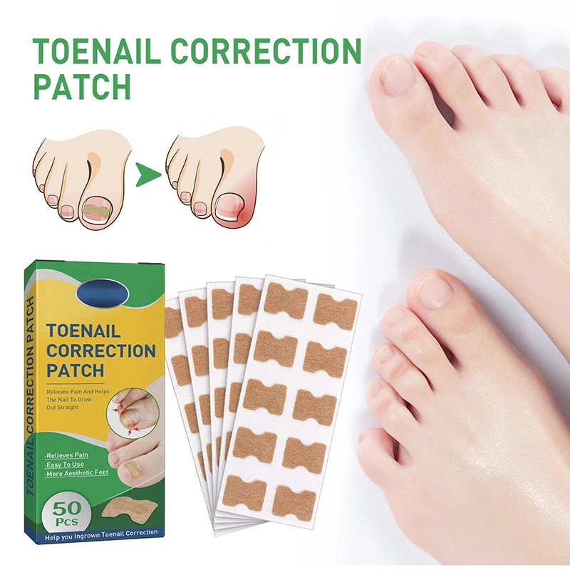 

Paronychia Cure Toenail Groove Sticker Elastic Ingrown Toenails Patch Nail Corrector 50PCS Health Care Pedicure Tool Relief Pain