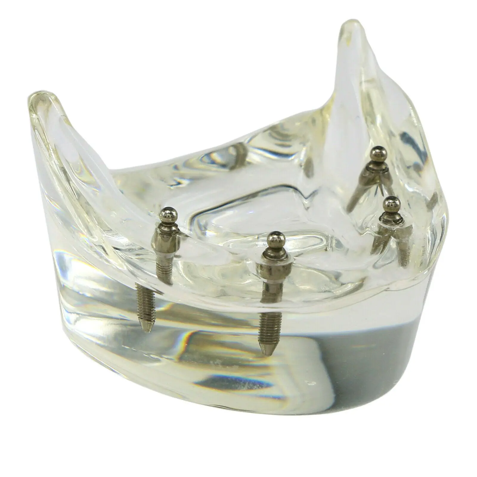NEW Dental Implant Tooths Model Overdenture Inferior with 4 Implants Demo #6003
