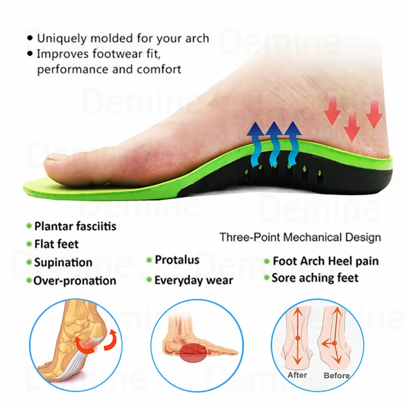 Orthopedic Shoes Sole Insoles For feet Arch Foot Pad X O Type Leg Correction Flat Foot