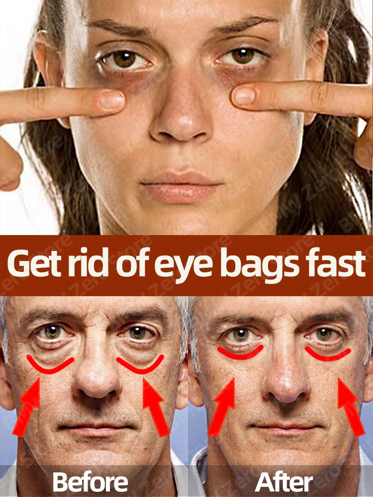 

Solve all eye problems