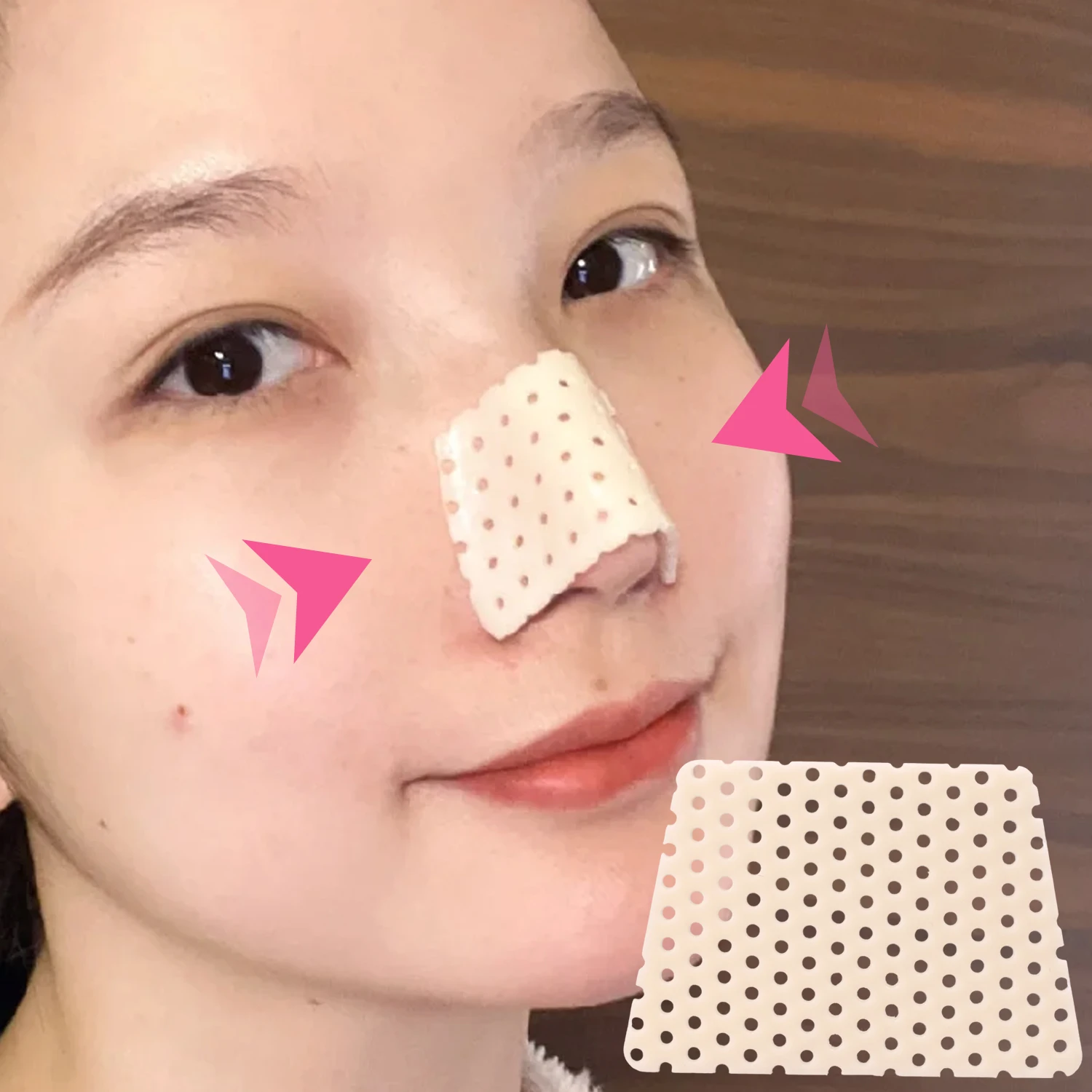 Thermoplastic Nose Splint for Fracture Support and Fixation