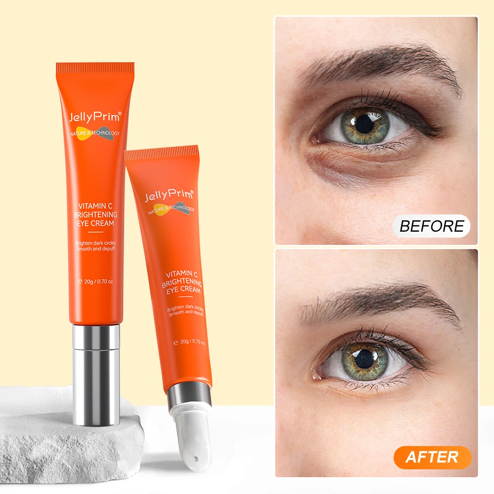 DarkCircleEyeCreamEyeBagsRemovalVitaminCHyaluronicAcid