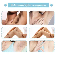 Permanent Hair Removal Spray Painless Hair Remover for Ladies Armpit Legs Arms Hair Growth Inhibitor Depilatory Body Cream Care 2
