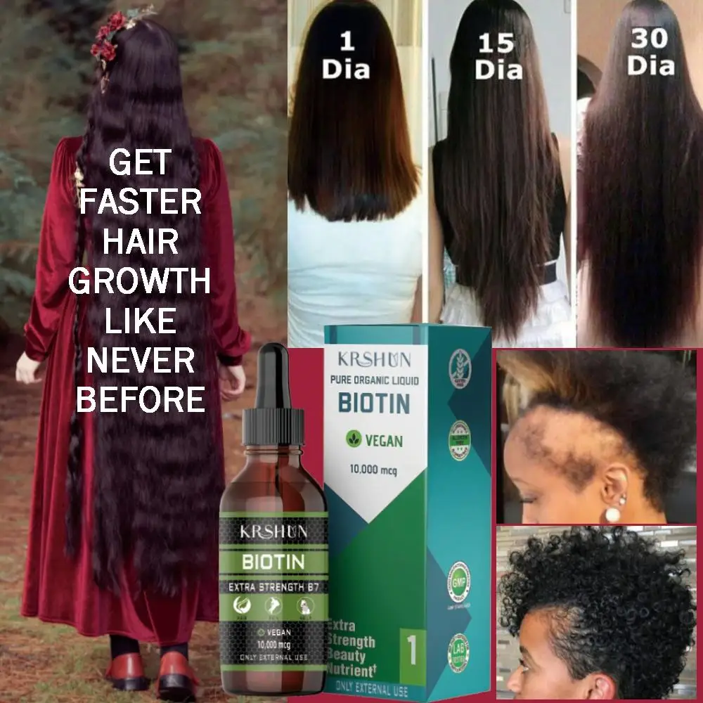 2022 Biotin Fast Hair Growth Oil Hair Regrowth Serum Hair Thinning  Treatment Hair Growth Liquid Anti-hair Loss For Women & Men - Hair Loss  Product Series - AliExpress