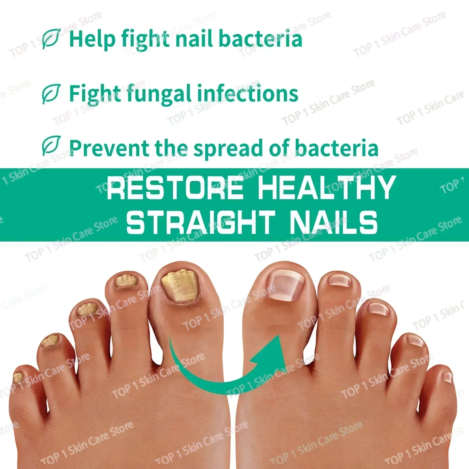 Fungal Nail Treatment Oil Foot Repair Essence Toe Nail Fungus Removal Gel Anti Infection Cream Fungal Removal