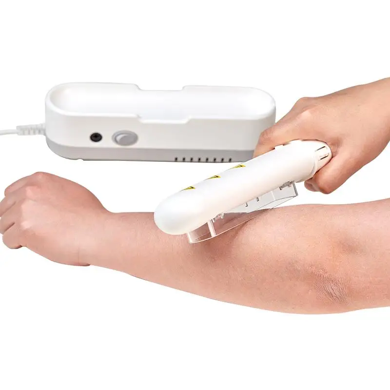 

SIGMA Portable 311nm UVB Phototherapy Device SH3B for Vitiligo Psoriasis Eczema Dermatitis