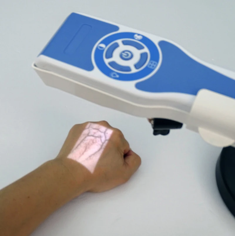 

Infrared blood vessels vein finder