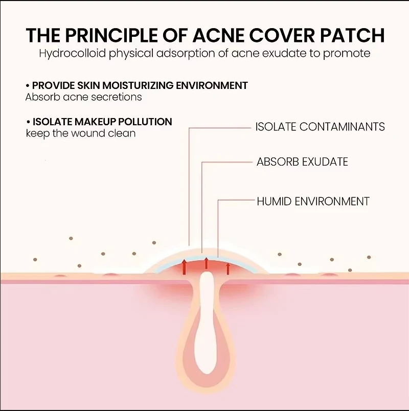 Repair Acne Patch Facial Skin Care Fade Blemishes Pimple Marks Closed Acne Blemishes Cover Acne Pimple Repair Patch