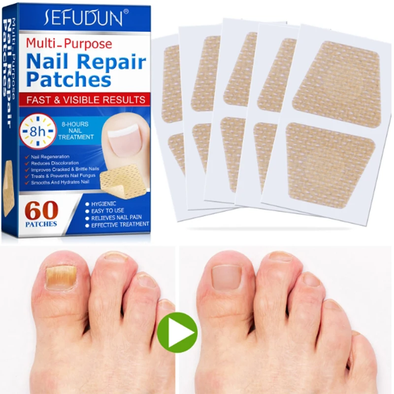 

60 шт./коробка, корректирующие наклейки для ногтей