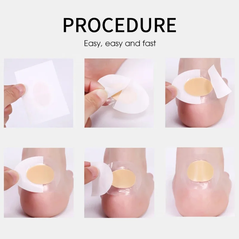 Átlátszó hidro-kolloid sarokbetét cipő felületén