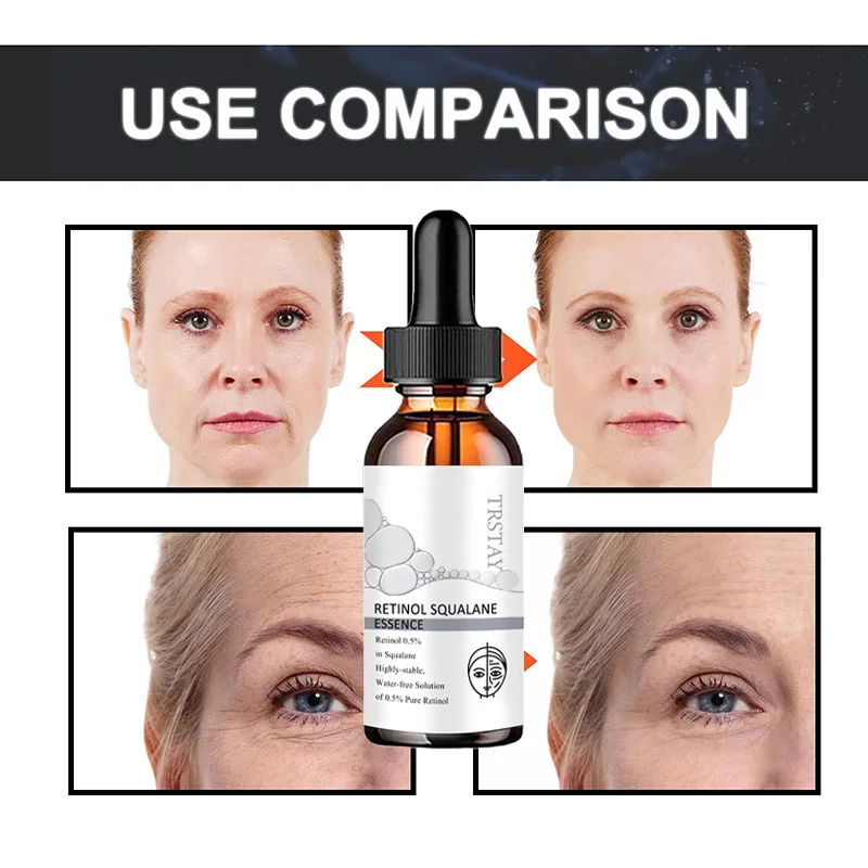 retinol squalane essence reduces fine lines, tightens skin, improves damaged skin, and makes skin soft and delicate 5