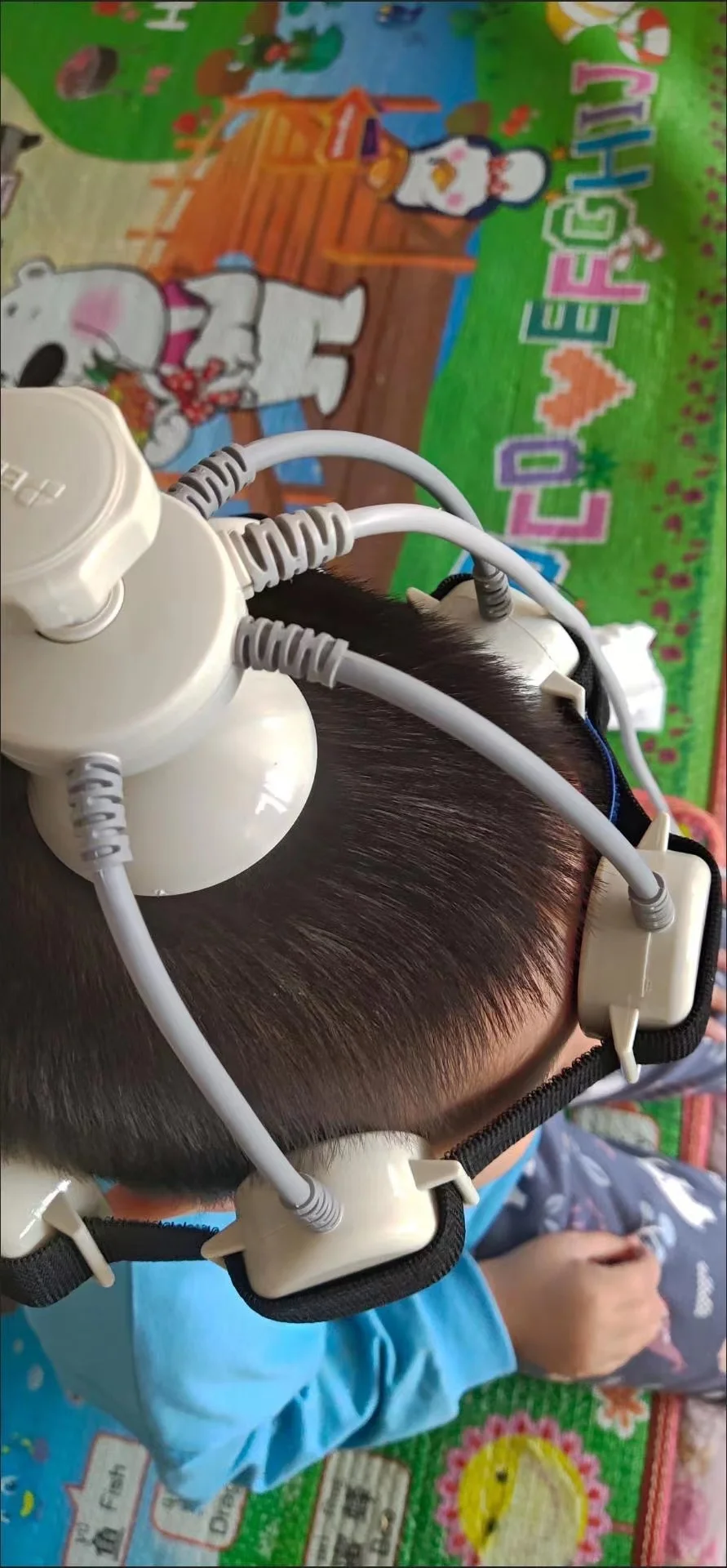 Transcranial Magnetic Stimulator