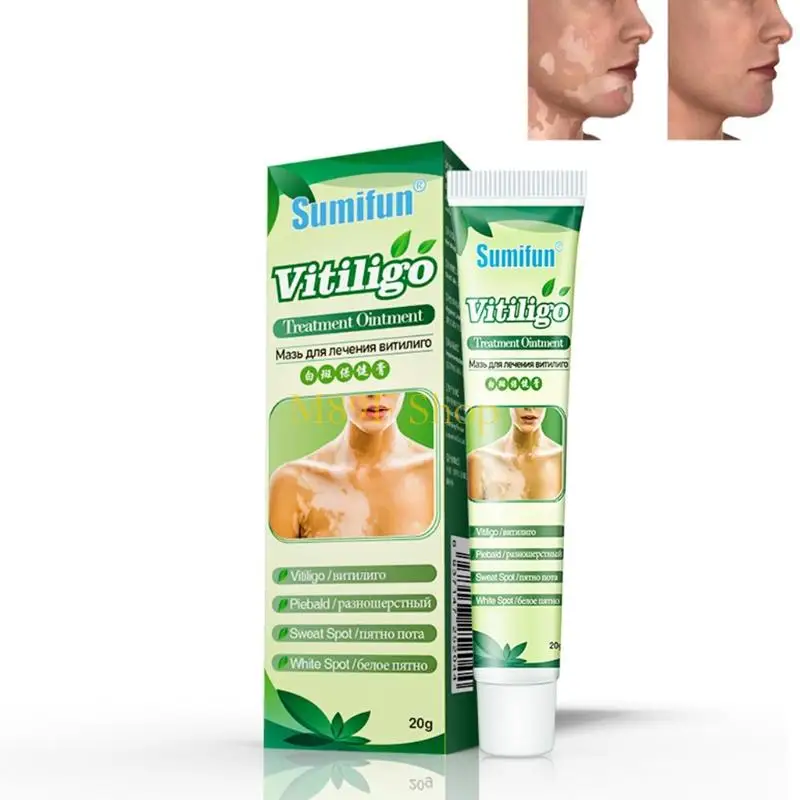 M89F 20g White Spot Localized VitiligoTreament Cream Cream Ointment Mycosis Leukoplakia