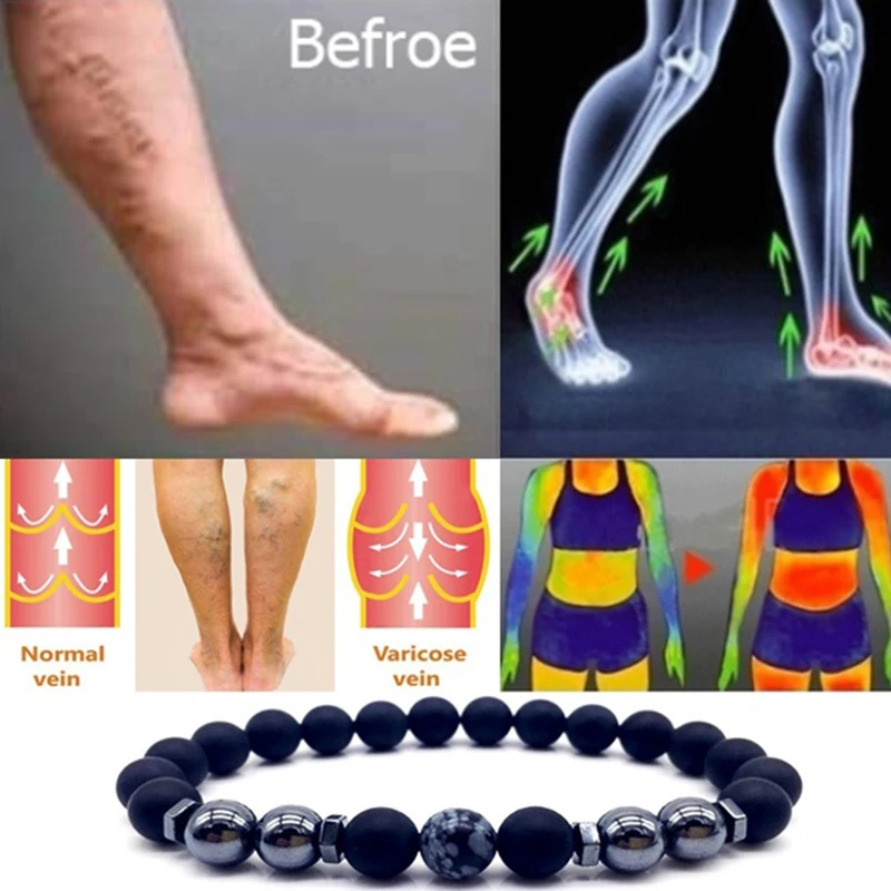 Magnet Anklet Colorful Stone eight Loss Magnetic Therapy Bracelet Slimming Health Care jewelry Weight Loss Product