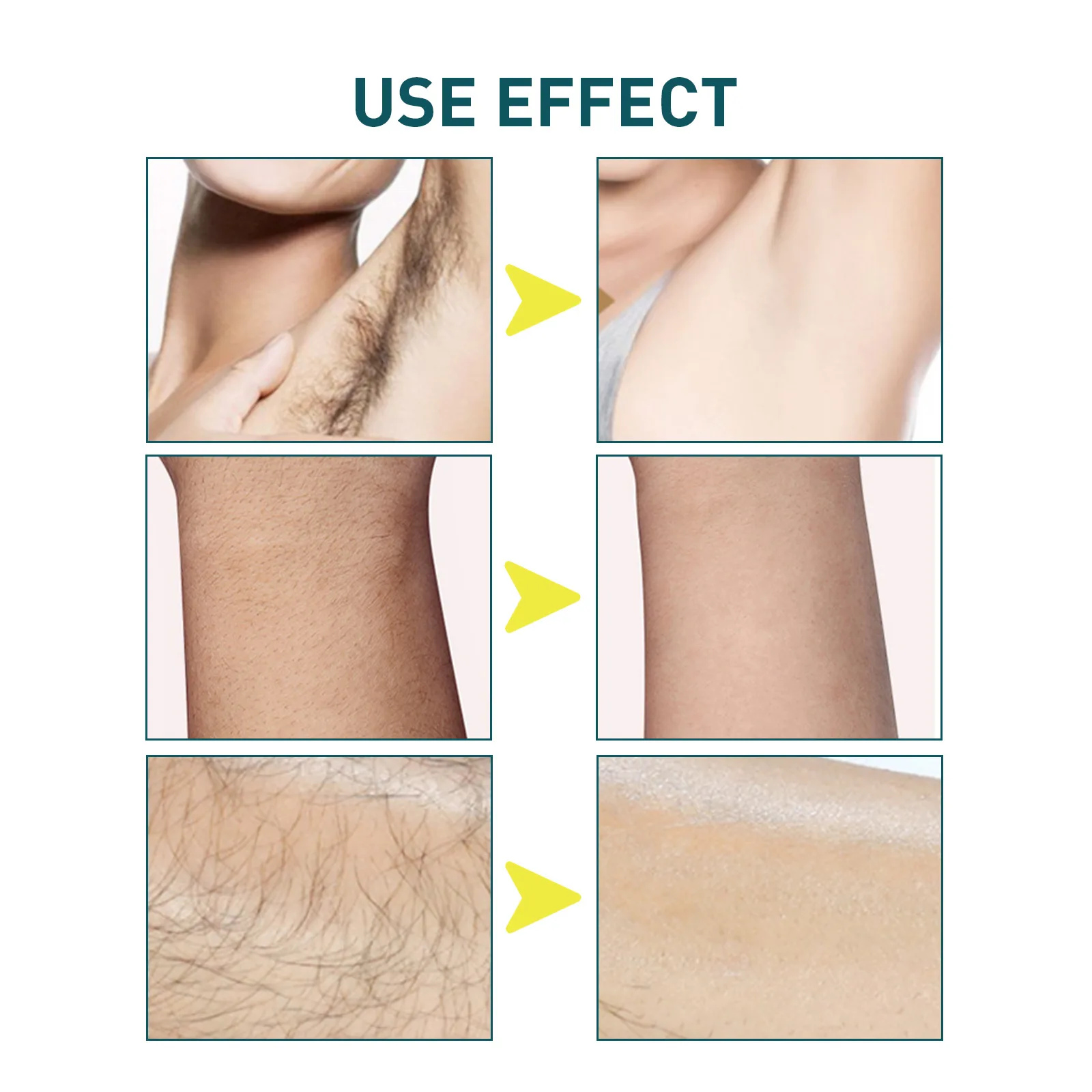 Wax Strips Paper for Hair Removal Double Sided Cold Waxing Wipe Stickers Professional Leg Arm Body Upper Lip Facial Epilator Set 3