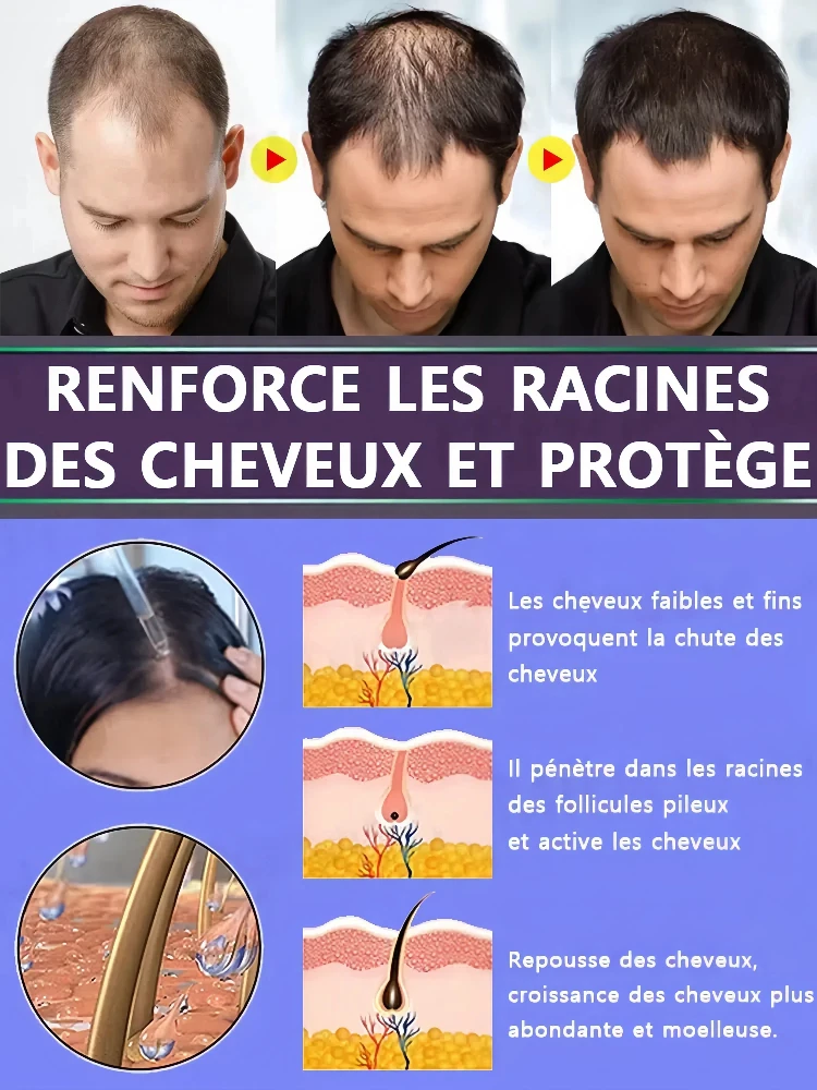 Revive Hair Strong Penetration Activate Hair Roots More Hair Say Goodbye to Baldness Thick Hair hair growth serum hair building powder hair building fibers hair growth spray hair growth cream hair growth shampoo set